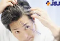 دیگر با موهای سفید خداحافظی کنید !