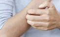 علائم و نشانه‌های پوستی کرونا