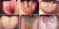 رابطه رنگ زبان و سلامت+ عکس