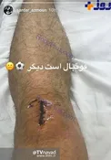 استوری جدید آزمون در اینستاگرام +عکس