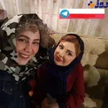 مو و شال عجیب و غریب بازیگر زن مشهور