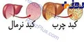 هشدار رئیس شبکه هپاتیت؛آمار ایرانیان نگران کننده است