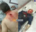 هشدار! /تصویری دردناک که برای همه گروه ها مناسب نیست