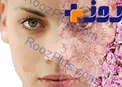 با علائم لوپوس پوستی آشنا شوید
