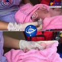 عکس/ تولد نوزاد ۲۴ انگشتی