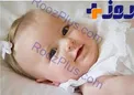 چرا بینی بانوان باردار بزرگ می شود؟