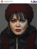 چهره ناک اوت شده بهاره رهنما/ عکس