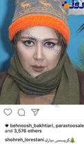 عکسی باورنکردنی از تغییر چهره و ظاهر بازیگر خانم