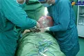 خروج یک توده رحمی 3 کیلویی از شکم بیمار چمستانی! +عکس