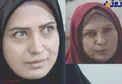 عکس/معجزه بوتاکس بازیگر زن ایرانی