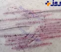 شیوع پدیده وحشتناک «خون‌بازی» در دانش‌آموزان