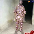 مردی که جای دست ها و پاهایش به هم عوض شده است! +عکس