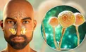 چه کسانی قارچ سیاه می‌گیرند؟