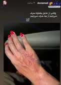 عکس/ بلایی که عشق یه طرفه سر دنیا مدنی آورد!