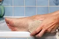 این بیماری را با سنگ پا درمان کنید
