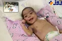 توده ای که  از قلب نوزاد سه ماهه خارج شد+عکس