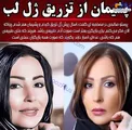 پشیمان شدن خانم بازیگر پرحاشیه از تزریق ژل به صورتش+عکس