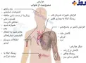 عوارض ديرخوابي + عکس