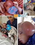 توموری عجیب در مغز کودک ۲ ساله! +عکس