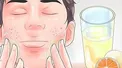 موثرترین روش‌ها برای جلوگیری از جوش صورت