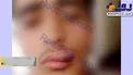 مجروح شدن دانش آموز توسط معلم ورزش+ عکس
